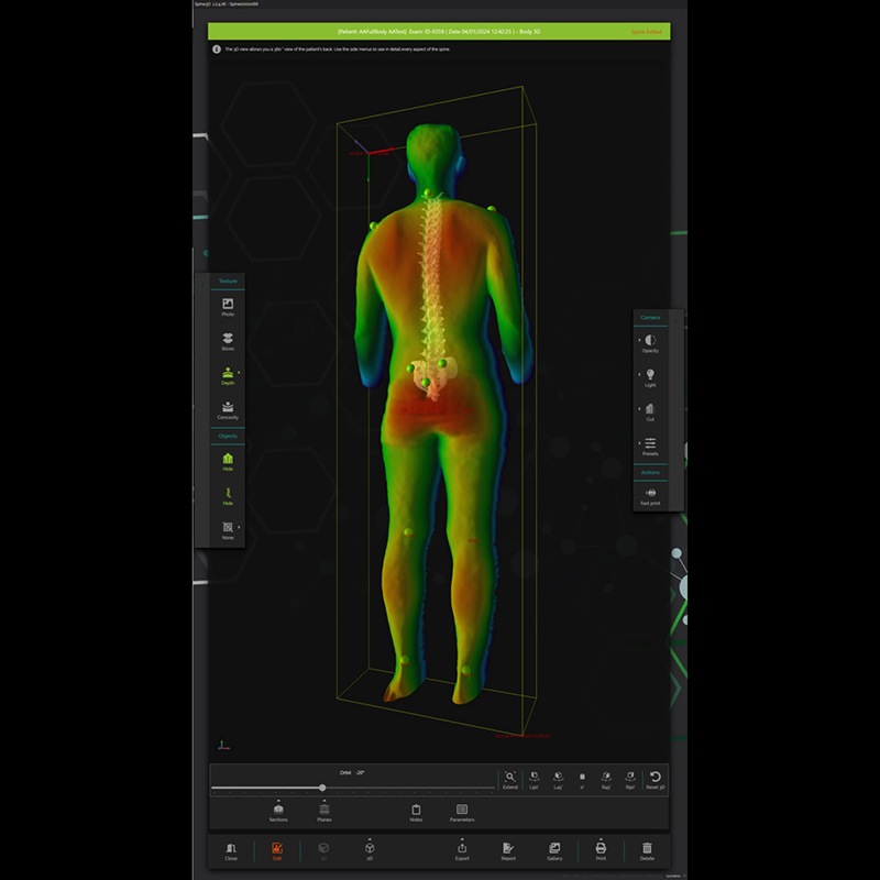 Система трёхмерного сканирования позвоночника Spine3D